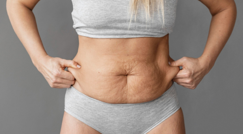 Saiba como o treino pode ajudar a reduzir a flacidez após o emagrecimento