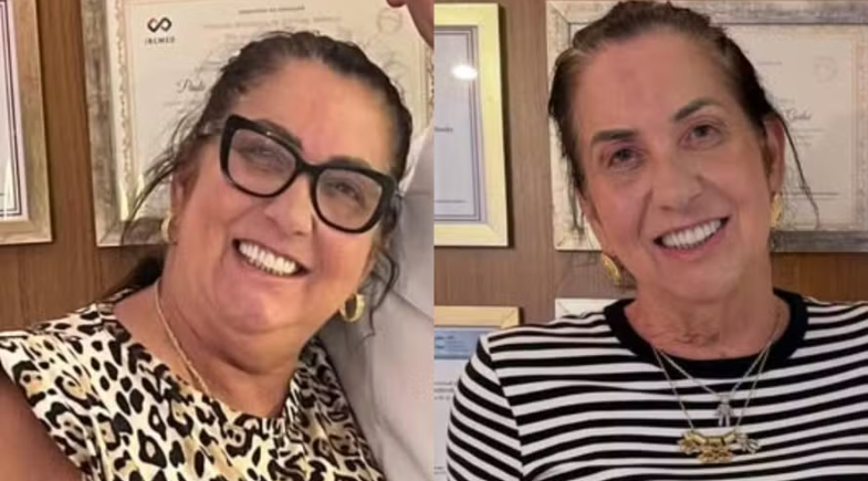 Médico celebra antes e depois de mãe de Virginia após combo de plásticas