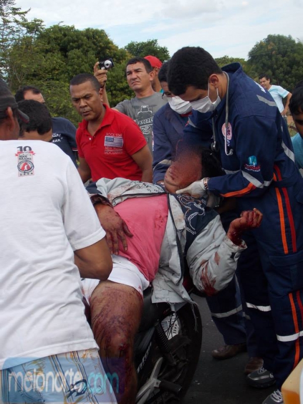 Acidente envolvendo Kombi e moto deixa dois jovens gravemente feridos - Imagem 6