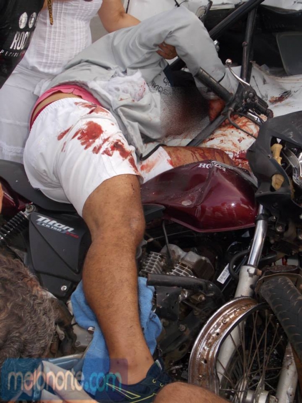 Acidente envolvendo Kombi e moto deixa dois jovens gravemente feridos - Imagem 2