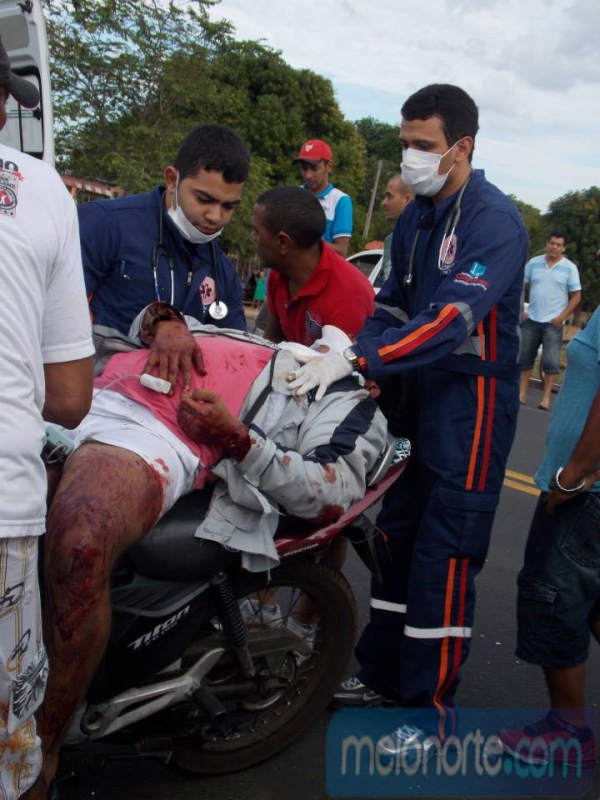 Acidente envolvendo Kombi e moto deixa dois jovens gravemente feridos - Imagem 5
