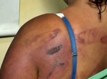 Em Balsas, mulher é agredida pelo marido a golpes de facão