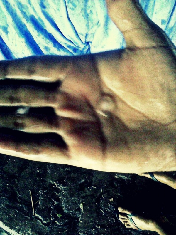 Chuva de Granizo? - Imagem 3