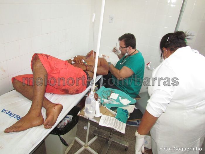 Durante briga, homem é atingido por tiro de espingarda em Barras - Imagem 2