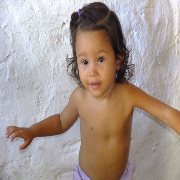 Criança com ossos de vidros no Piauí precisa de ajuda. - Imagem 7