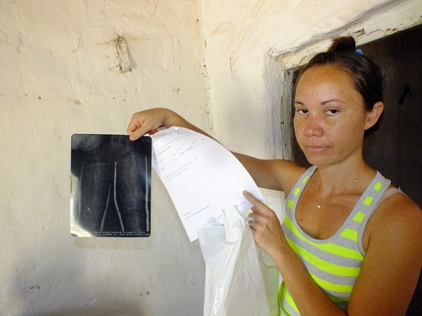 Criança com ossos de vidros no Piauí precisa de ajuda. - Imagem 19