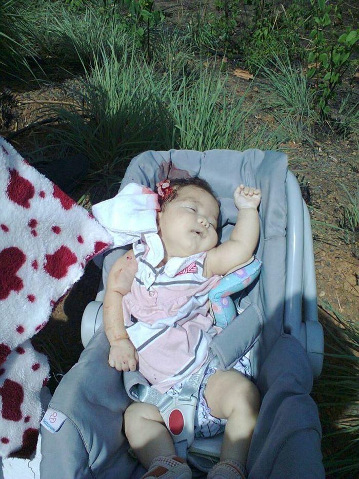  Alice e Aline vitima de um Grave Acidente em Estaca Zero  - Imagem 2