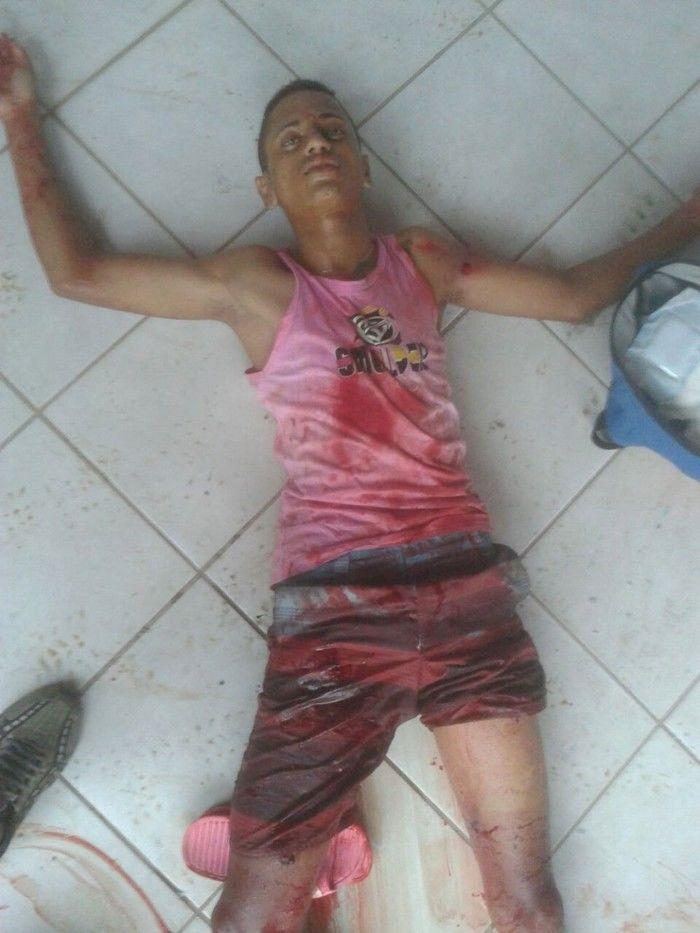 Bandido que Levou 02 tiros ao assaltar a Casa do Policial da Rone Não Resistiu e Morreu no HUT  - Imagem 2