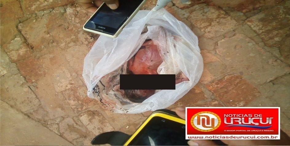 Corpo de rescém-nascido é encontrado dentro de tambor de lixo no Hospital de Uruçuí