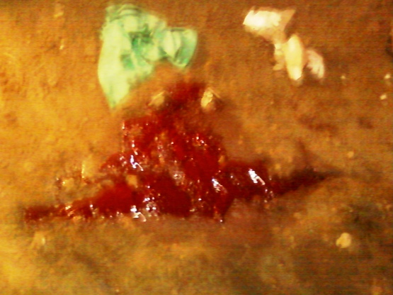 Jovem resiste a prisão e leva um tiro da policia em Agricolândia