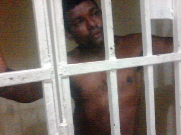  Homem queima roupa da esposa e ainda tenta matá-la 