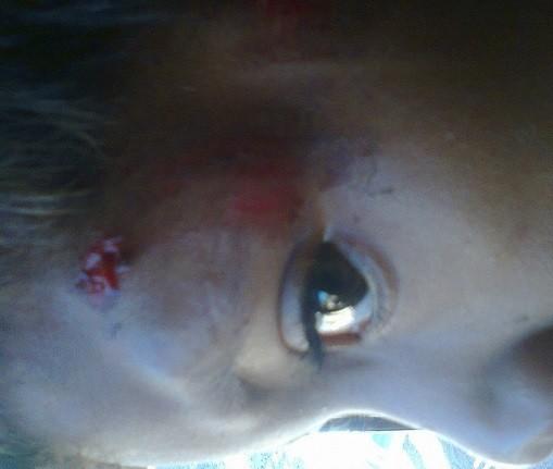 Atenção Conselho Tutelar de Barras: ‘Garoto é embriagado e agredido por outro aluno ’ - Imagem 2