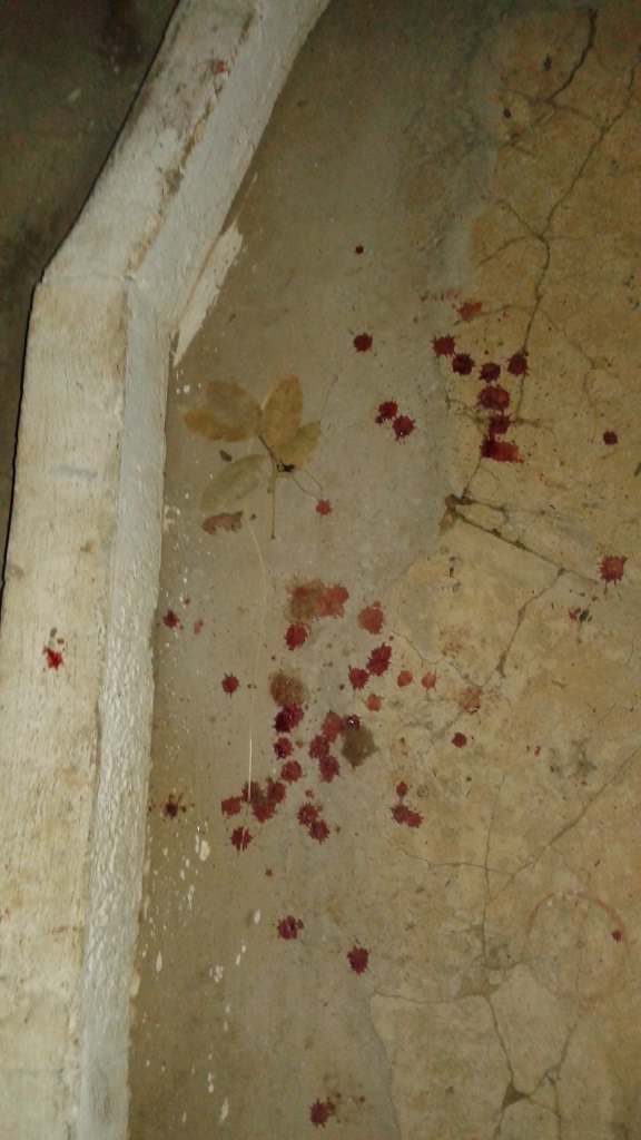 Acidente de Moto no Centro de Agricolândia deixa um jovem com Braço quebrado  - Imagem 3