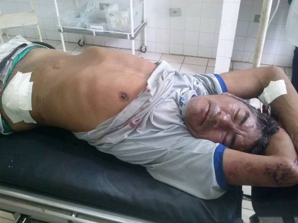 Garçom e pedreiro brigam por mulher, um termina preso e outro esfaqueado - Imagem 2