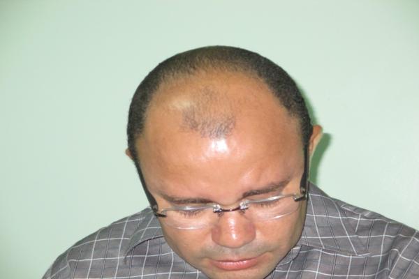 Toma posse o novo diretor do Hospital Regional Dr. Francisco Ayres Cavalcante - Imagem 66