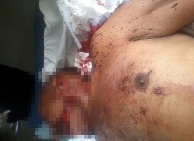 Idoso morre após sofre grave acidente na PI-115 - Imagem 1