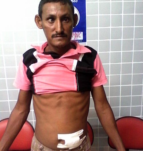 Briga de vizinhos termina com um ferido a facas na região de Campo Maior - Imagem 1