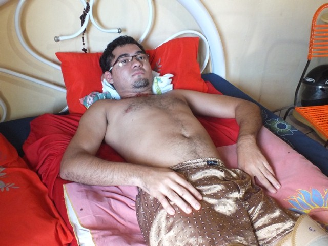 Dengue provoca paralisia em jovem depois de 12 anos - Imagem 15