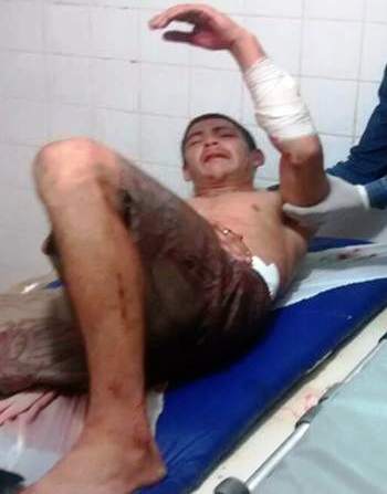 Homem é esfaqueado em festa na região de Campo Maior - Imagem 2