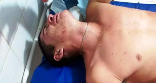 Homem é esfaqueado em festa na região de Campo Maior - Imagem 1