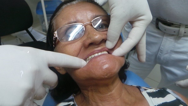 Prefeitura de Pimenteiras distribuiu próteses dentarias  - Imagem 6