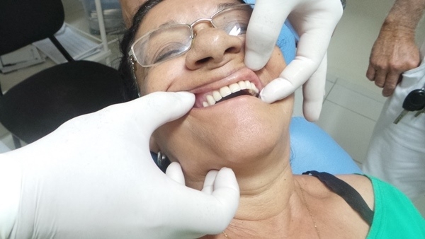 Prefeitura de Pimenteiras distribuiu próteses dentarias  - Imagem 3