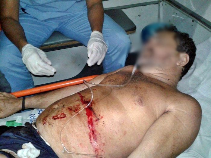 Homem é baleado durante assalto, reage e mata bandido no norte do Piauí - Imagem 1