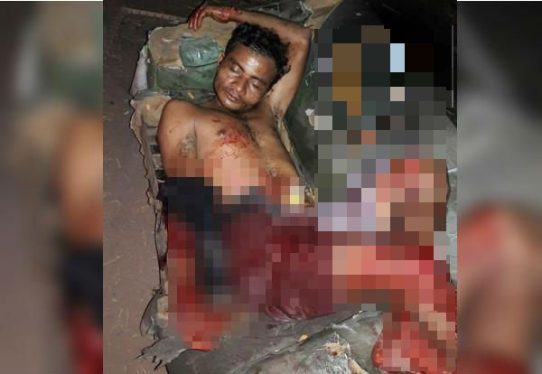 Homem é atingido com golpe de facão no interior do Piauí