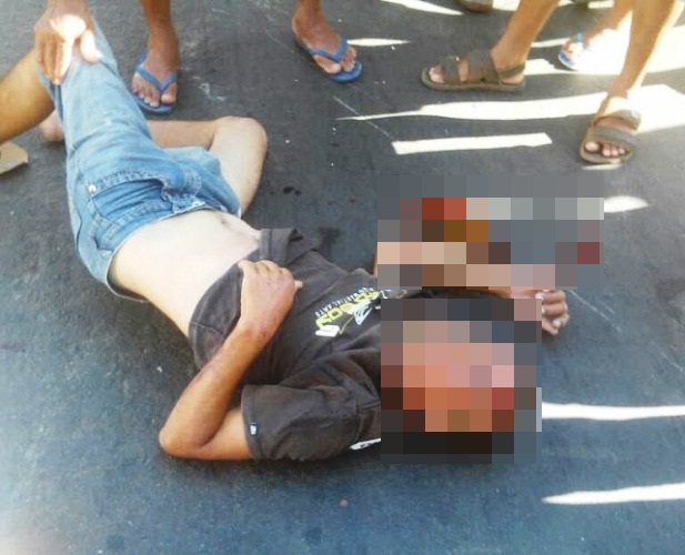 Homem fica gravemente ferido após colisão entre moto e carro - Imagem 1