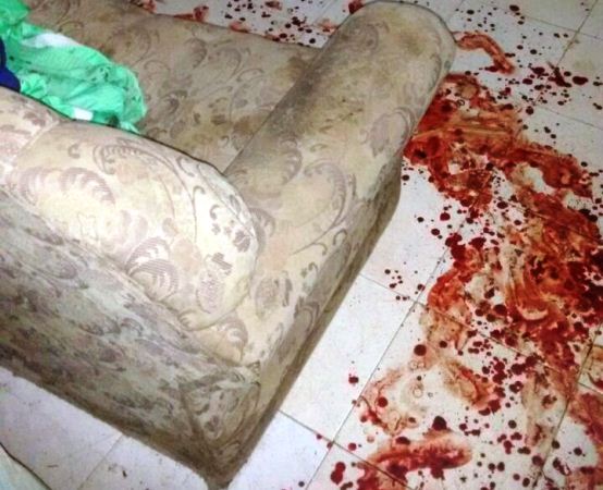 Irmãos roubam e tentam matar idosa estrangulada e a facadas - Imagem 2