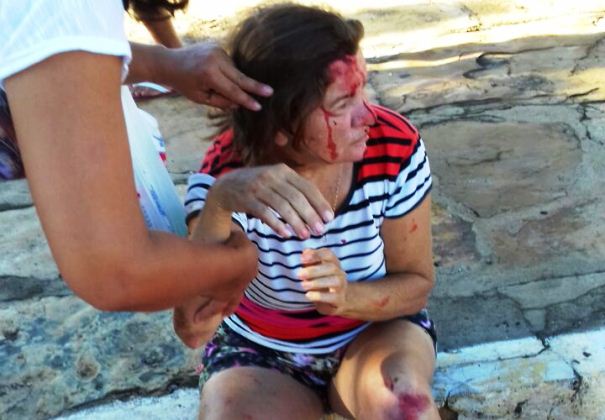 Filho de ex-prefeito é preso após ferir mulher em colisão - Imagem 1