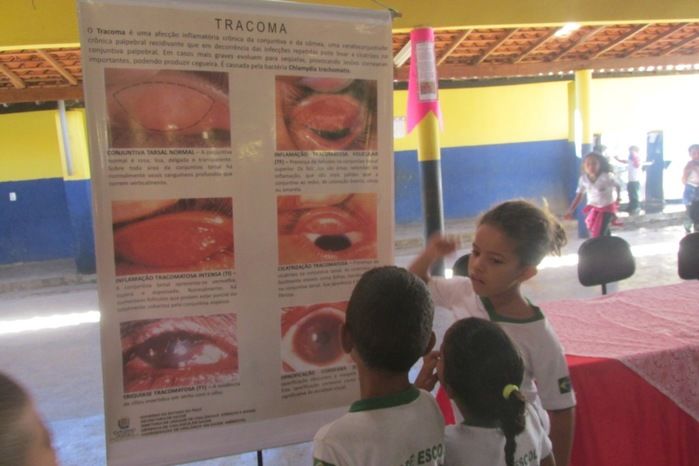 Campanha do Tracoma é Realizada nas Escolas em Agricolândia - Imagem 8