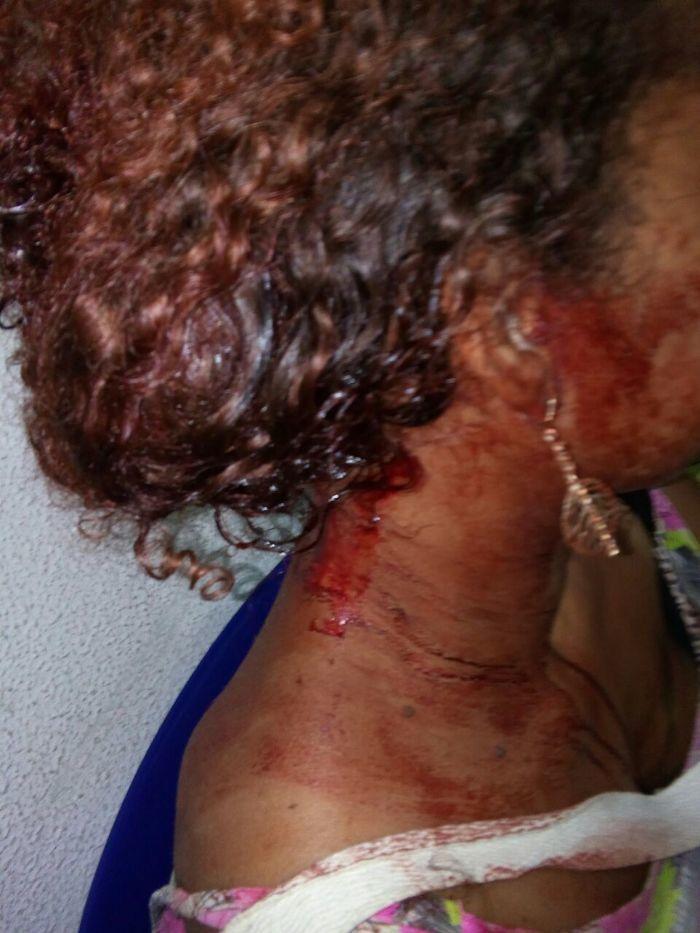 Vítima foi golpeada pelo marido (Crédito: Reprodução)