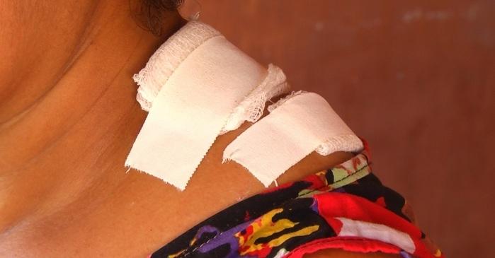Mulher foi atingida de raspão no ombro.  (Crédito: Kairo Amaral)