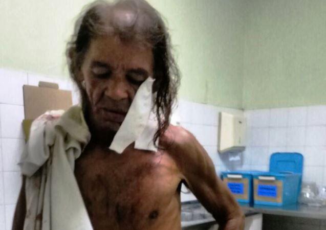 Idoso é atingido por dois tiros no rosto - Imagem 1