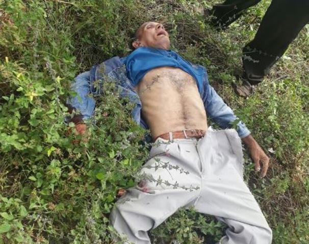 Idoso de 65 anos sofre grave acidente na BR-343 em Campo Maior - Imagem 1