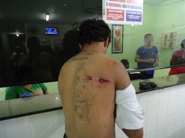 Jovem é baleado de raspão na garupa de uma moto em Parnaíba - Imagem 1