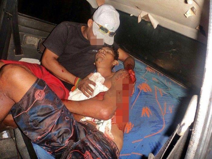 Homem é baleado no peito e esfaqueia autor do disparo em Parnaíba - Imagem 1