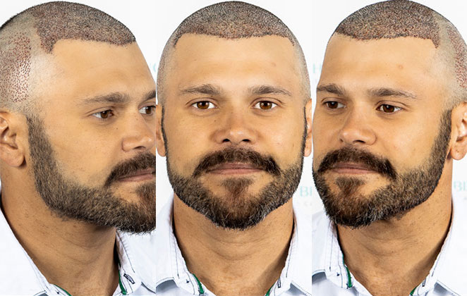 Marcos, da dupla com Belluti