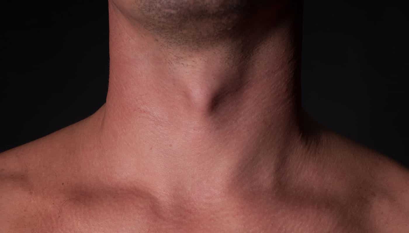 Tiroides, image size:1400x800