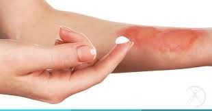 Puxar o pino da panela de pressão pode ser mais perigoso do que você imagina - Imagem 1