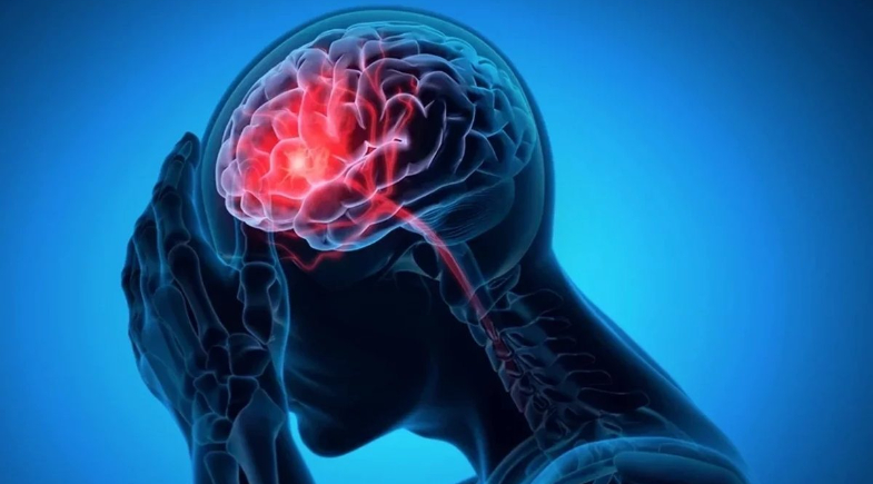 Acidente Vascular Cerebral (AVC)  | Reprodução