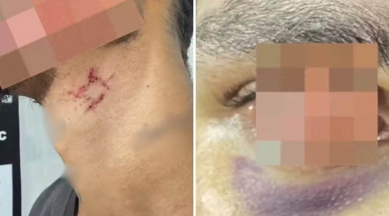 Jovem resgatado de cárcere privado em Goiânia | Reprodução