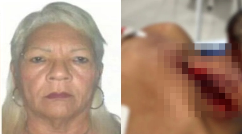 A mulher provocou o corte profundo usando uma navalha | Reprodução