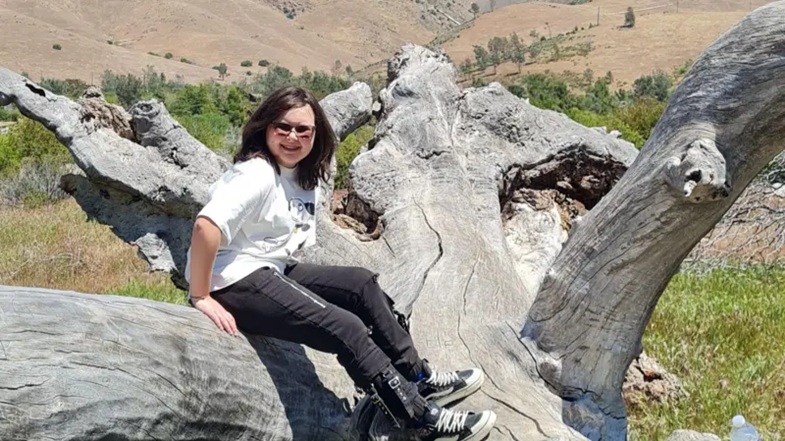 Hoje, o câncer de Alyssa é indetectável, e ela precisa apenas de exames anuais | Reprodução