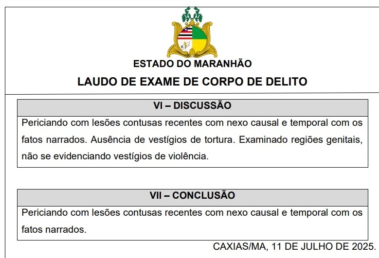 Laudo nega tortura após suspeito de matar delegado alegar ter sido agredido  - Imagem 1