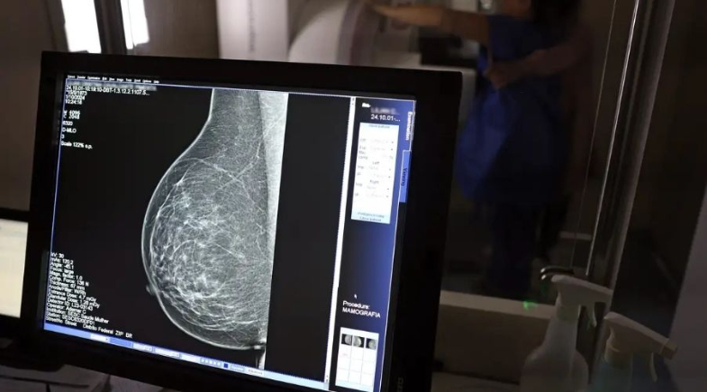 Outubro Rosa: câncer de mama cresce e atinge cada vez mais mulheres jovens | José Cruz/Agência Brasil