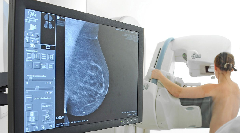 Prefeitura de José de Freitas promoverá a ação Mamografia Móvel para mulheres do município