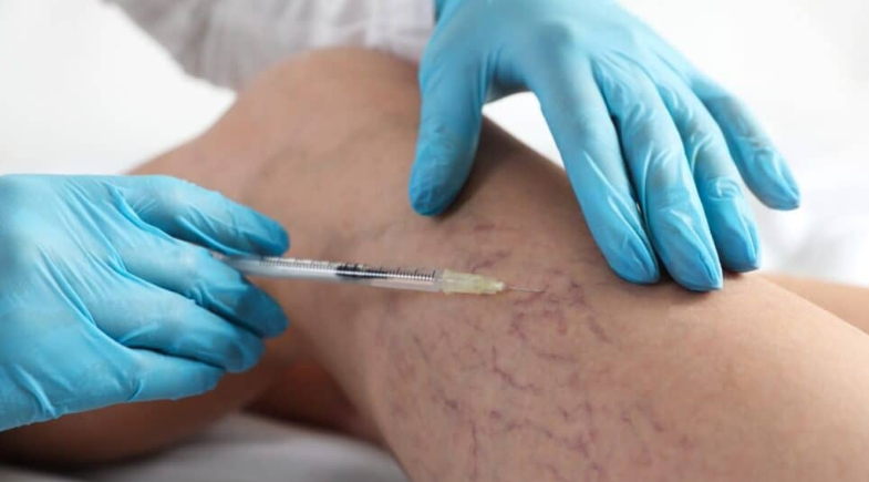 Prefeitura de Lagoa do Barro do Piauí promoverá Mutirão de Cirurgia Vascular