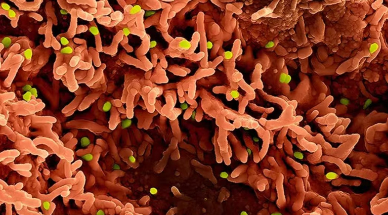 Partículas do vírus mpox (em verde) sobre células infectadas | NIH-NIAID/IMAGE POINT FR/BSIP/picture alliance